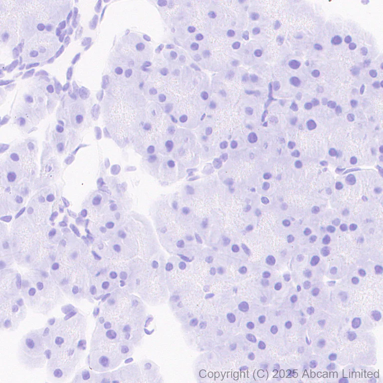 Immunohistochemistry (Formalin/PFA-fixed paraffin-embedded sections) - Anti-YKL-40/CHI3L1 antibody [EPR29069-26] - BSA and Azide free (AB324461)