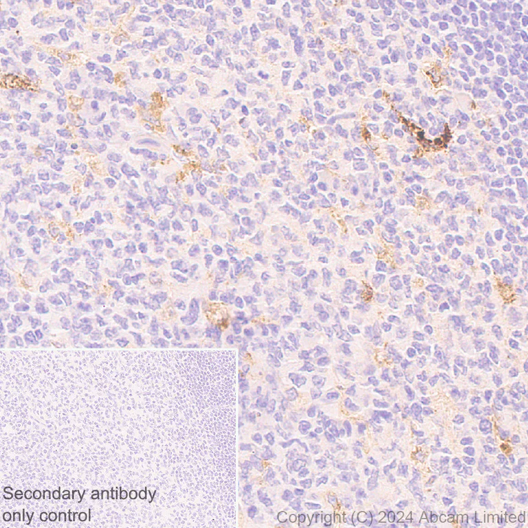 Immunohistochemistry (Formalin/PFA-fixed paraffin-embedded sections) - Anti-YKL-40/CHI3L1 antibody [RM1204] (AB319164)