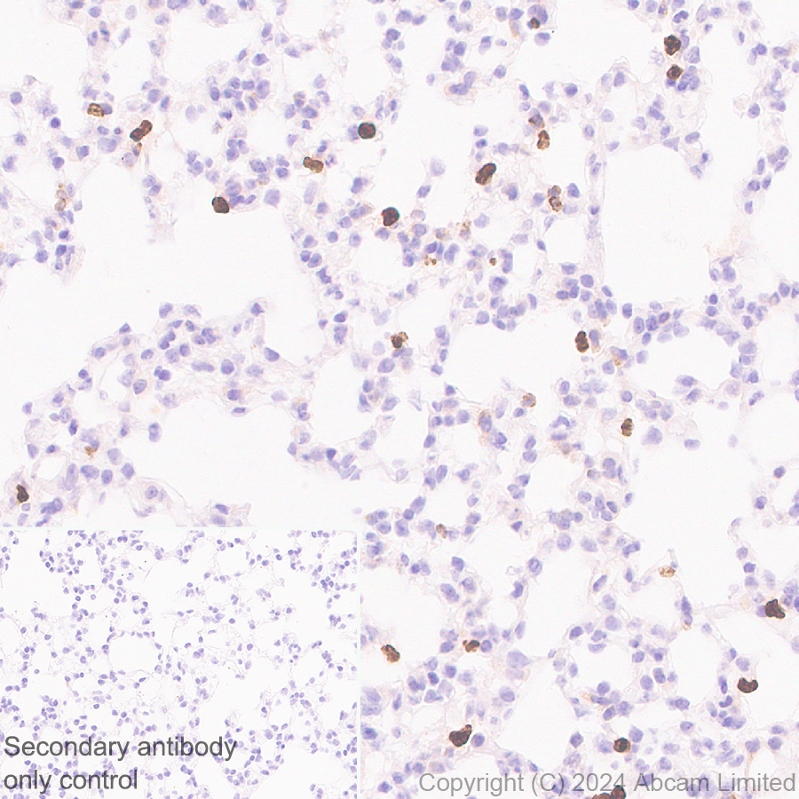 Anti-YKL-40/CHI3L1 antibody [RM1204] (ab319164) | Abcam