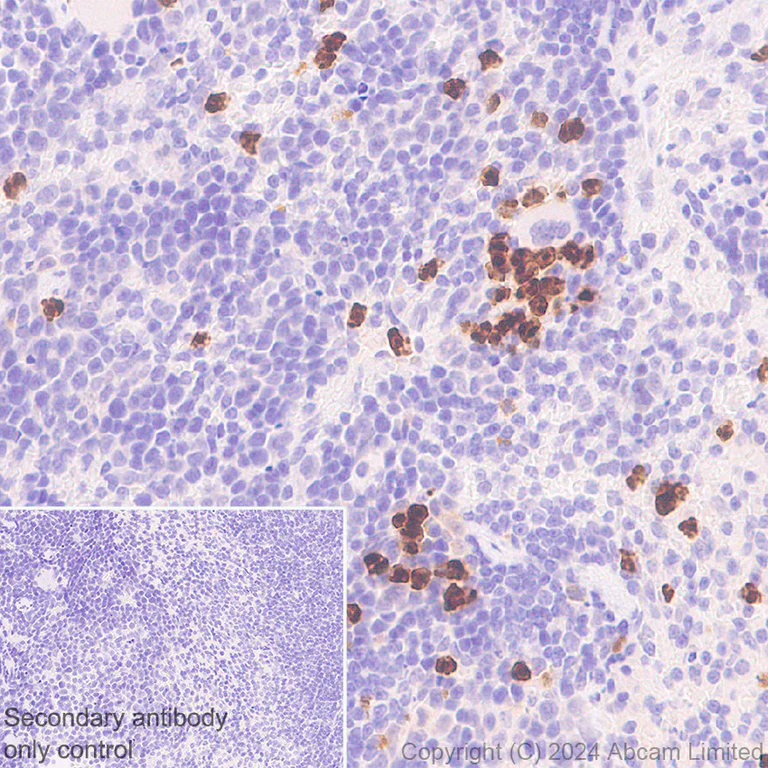 Immunohistochemistry (Formalin/PFA-fixed paraffin-embedded sections) - Anti-YKL-40/CHI3L1 antibody [RM1204] - BSA and Azide free (AB319165)