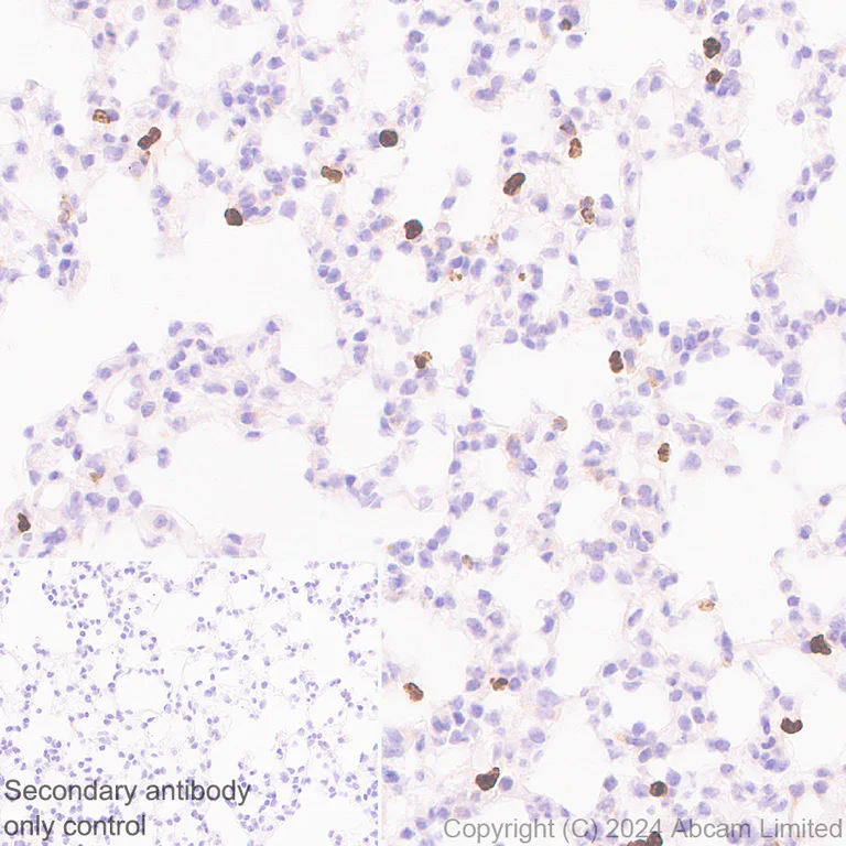 Immunohistochemistry (Formalin/PFA-fixed paraffin-embedded sections) - Anti-YKL-40/CHI3L1 antibody [RM1204] - BSA and Azide free (AB319165)