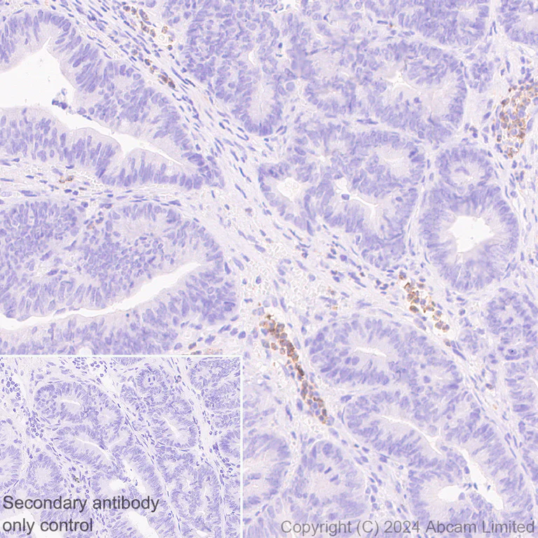 Immunohistochemistry (Formalin/PFA-fixed paraffin-embedded sections) - Anti-YKL-40/CHI3L1 antibody [RM1204] - BSA and Azide free (AB319165)