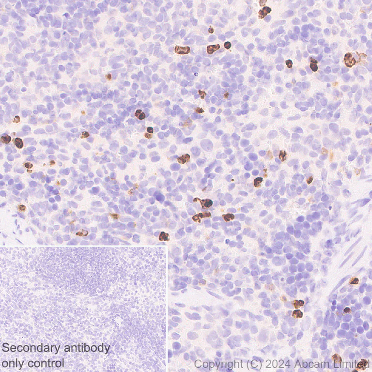 Immunohistochemistry (Formalin/PFA-fixed paraffin-embedded sections) - Anti-YKL-40/CHI3L1 antibody [RM1204] - BSA and Azide free (AB319165)