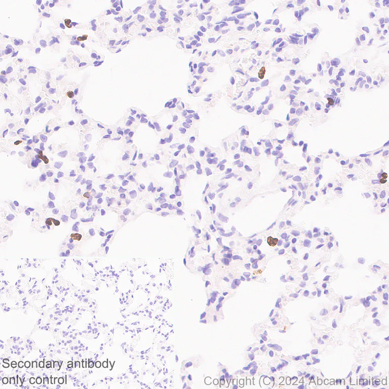 Immunohistochemistry (Formalin/PFA-fixed paraffin-embedded sections) - Anti-YKL-40/CHI3L1 antibody [RM1204] - BSA and Azide free (AB319165)