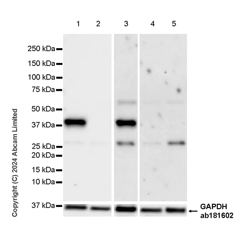 Western blot - Anti-YKL-40/CHI3L1 antibody [RM1204] - BSA and Azide free (AB319165)