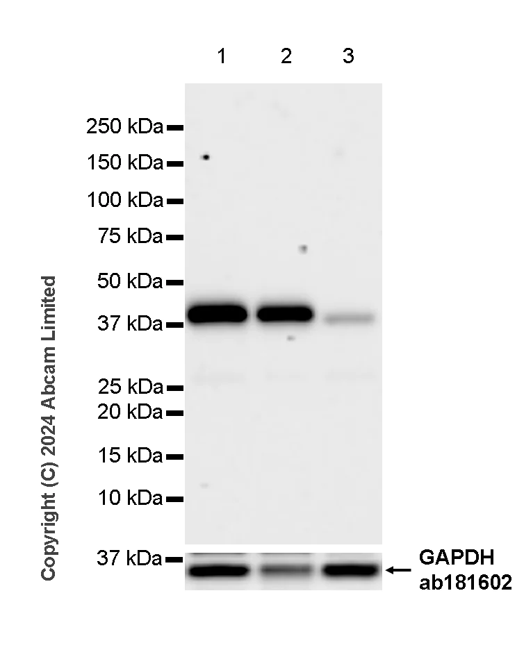 Western blot - Anti-YKL-40/CHI3L1 antibody [RM1204] - BSA and Azide free (AB319165)