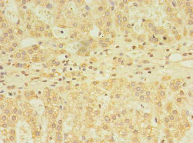 Immunohistochemistry (Formalin/PFA-fixed paraffin-embedded sections) - Anti-YKT6 antibody (AB236583), expandable thumbnail