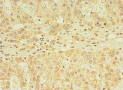 Immunohistochemistry (Formalin/PFA-fixed paraffin-embedded sections) - Anti-YKT6 antibody (AB236583)