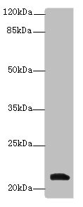 Western blot - Anti-YKT6 antibody (AB236583), expandable thumbnail