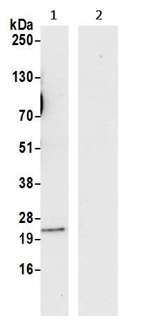 Immunoprecipitation - Anti-YKT6 antibody (AB241276)