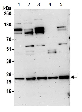 Western blot - Anti-YKT6 antibody (AB241276)