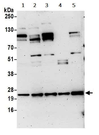 Western blot - Anti-YKT6 antibody (AB241276)