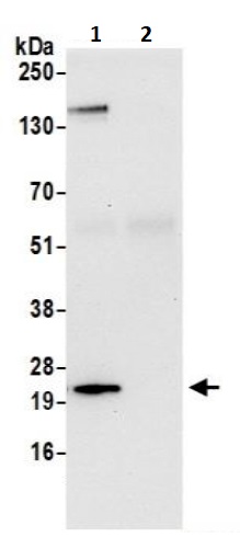 Immunoprecipitation - Anti-YKT6 antibody (AB241382), expandable thumbnail
