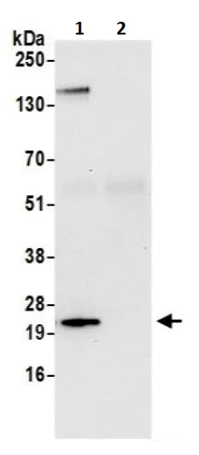 Immunoprecipitation - Anti-YKT6 antibody (AB241382)