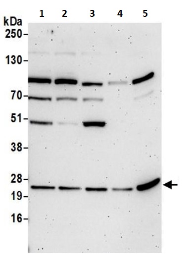 Western blot - Anti-YKT6 antibody (AB241382), expandable thumbnail
