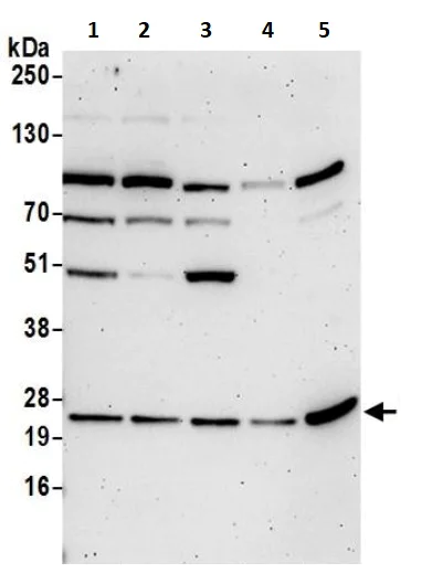 Western blot - Anti-YKT6 antibody (AB241382)