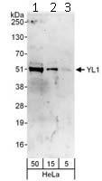 Western blot - Anti-YL1 antibody (AB112055)