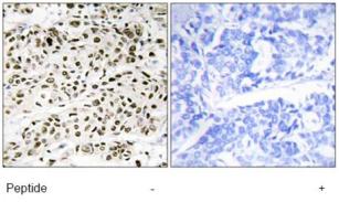Immunohistochemistry (Formalin/PFA-fixed paraffin-embedded sections) - Anti-YL1 antibody (AB72506)