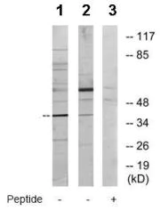 Western blot - Anti-YL1 antibody (AB72506)