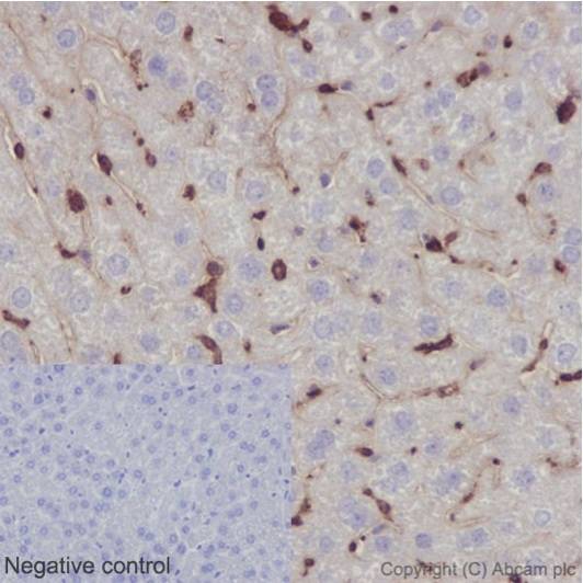 Immunohistochemistry (Formalin/PFA-fixed paraffin-embedded sections) - Anti-Ym-1 + Ym-2 antibody [EPR15263] (AB192029)