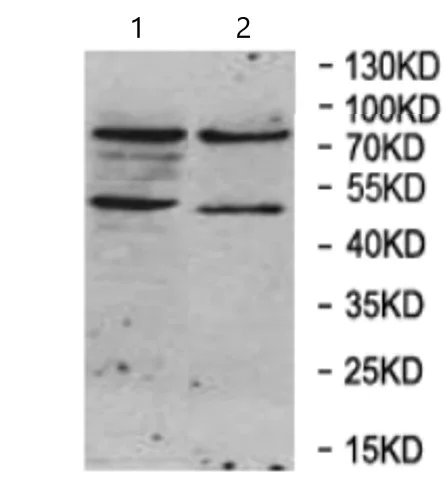 Western blot - Anti-YME1L1 antibody (AB170123)