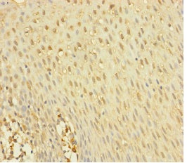 Immunohistochemistry (Formalin/PFA-fixed paraffin-embedded sections) - Anti-YME1L1 antibody (AB234744), expandable thumbnail