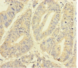Immunohistochemistry (Formalin/PFA-fixed paraffin-embedded sections) - Anti-YME1L1 antibody (AB234744), expandable thumbnail