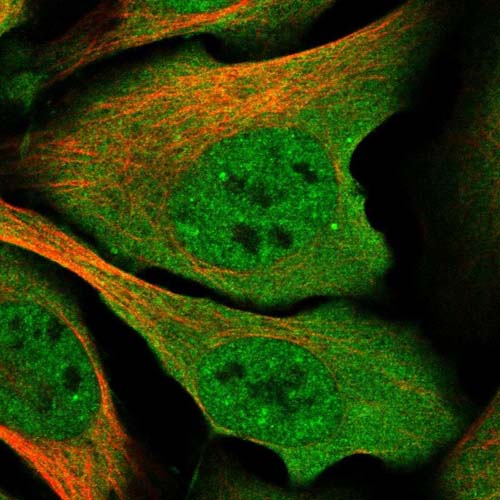 Immunocytochemistry/ Immunofluorescence - Anti-YTHDC1 antibody (AB122340)