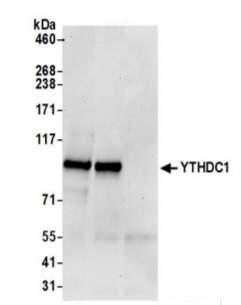 Immunoprecipitation - Anti-YTHDC1 antibody (AB264375)