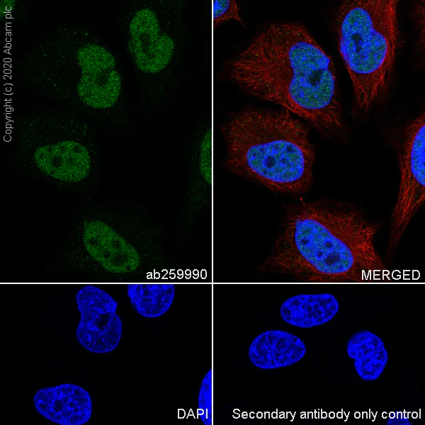 Immunocytochemistry/ Immunofluorescence - Anti-YTHDC1 antibody [EPR21821-213] (AB259990)