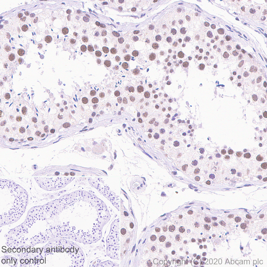 Immunohistochemistry (Formalin/PFA-fixed paraffin-embedded sections) - Anti-YTHDC1 antibody [EPR21821-213] (AB259990), expandable thumbnail