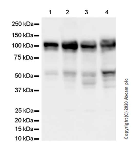 Western blot - Anti-YTHDC1 antibody [EPR21821-213] (AB259990)