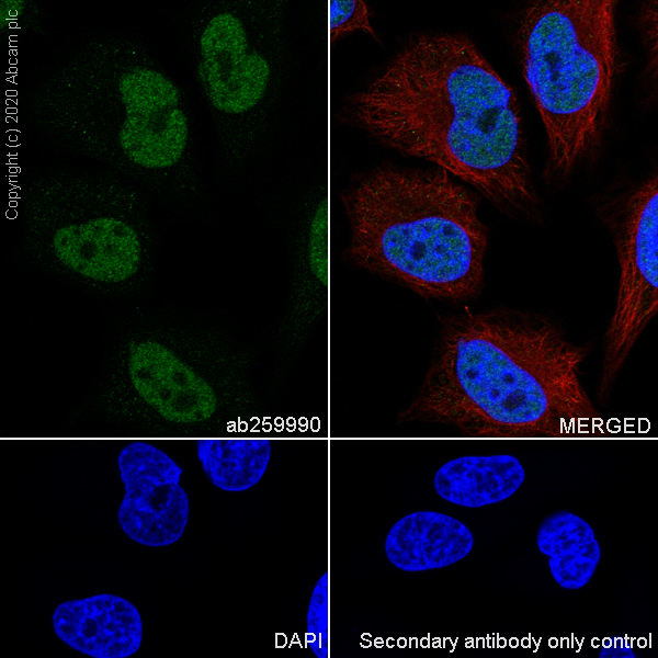 Immunocytochemistry/ Immunofluorescence - Anti-YTHDC1 antibody [EPR21821-213] - BSA and Azide free (ab282289), expandable thumbnail