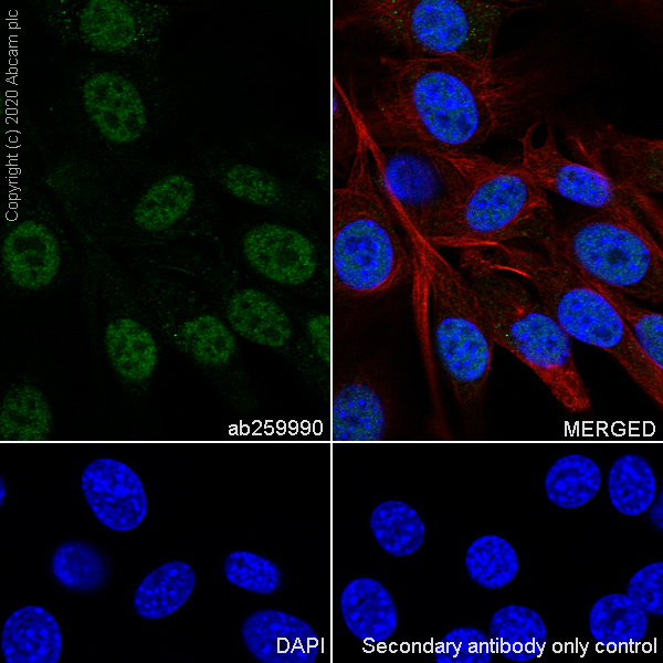 Immunocytochemistry/ Immunofluorescence - Anti-YTHDC1 antibody [EPR21821-213] - BSA and Azide free (ab282289), expandable thumbnail