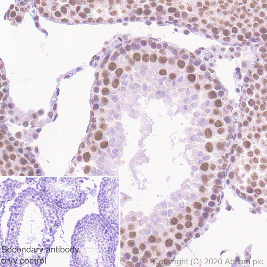 Immunohistochemistry (Formalin/PFA-fixed paraffin-embedded sections) - Anti-YTHDC1 antibody [EPR21821-213] - BSA and Azide free (AB282289), expandable thumbnail