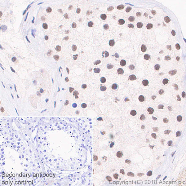 Immunohistochemistry (Formalin/PFA-fixed paraffin-embedded sections) - Anti-YTHDC1 antibody [EPR21821] - BSA and Azide free (AB251648)