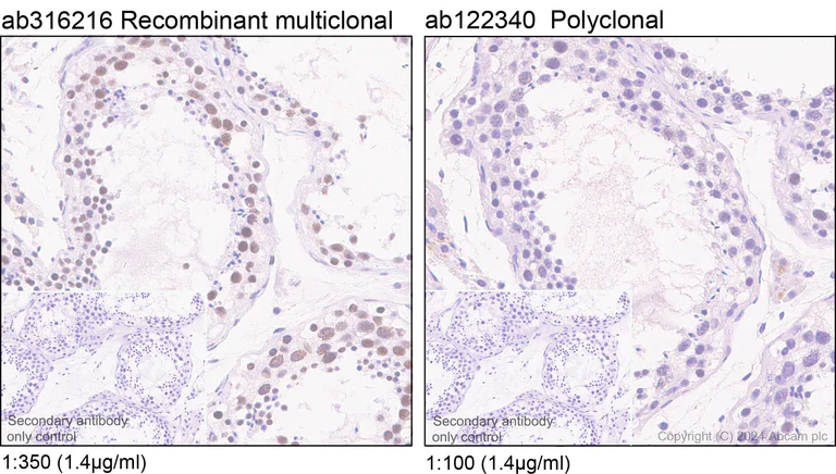 Immunohistochemistry (Formalin/PFA-fixed paraffin-embedded sections) - Anti-YTHDC1 antibody [RM1107] - BSA and Azide free (AB316217)