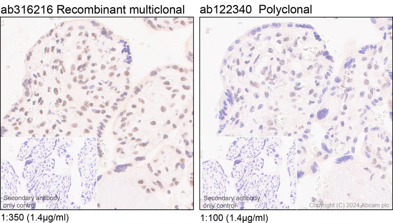 Immunohistochemistry (Formalin/PFA-fixed paraffin-embedded sections) - Anti-YTHDC1 antibody [RM1107] - BSA and Azide free (AB316217)