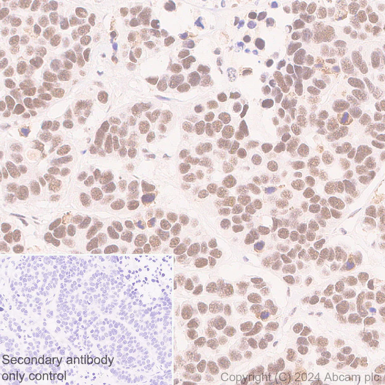 Immunohistochemistry (Formalin/PFA-fixed paraffin-embedded sections) - Anti-YTHDC1 antibody [RM1107] - BSA and Azide free (AB316217)