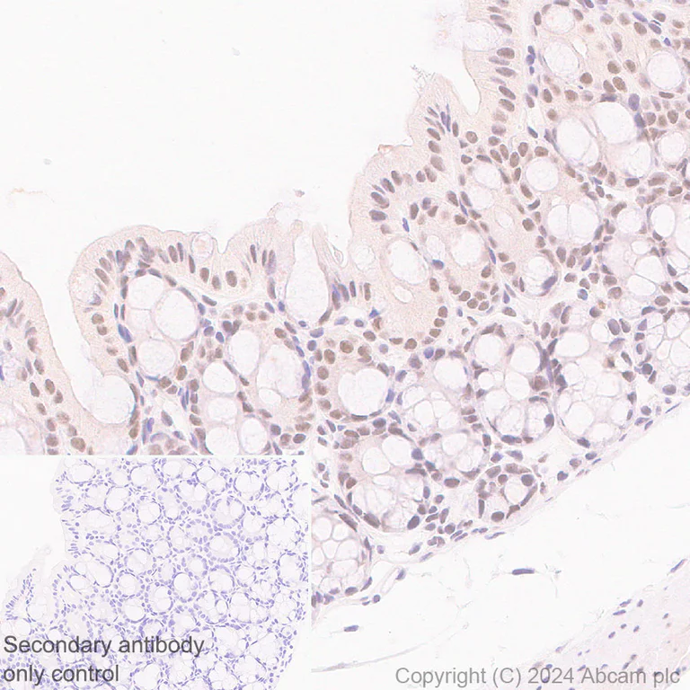 Immunohistochemistry (Formalin/PFA-fixed paraffin-embedded sections) - Anti-YTHDC1 antibody [RM1107] - BSA and Azide free (AB316217)