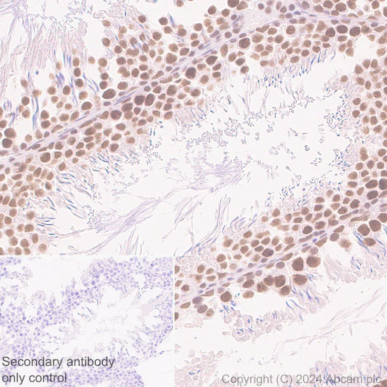 Immunohistochemistry (Formalin/PFA-fixed paraffin-embedded sections) - Anti-YTHDC1 antibody [RM1107] - BSA and Azide free (AB316217)