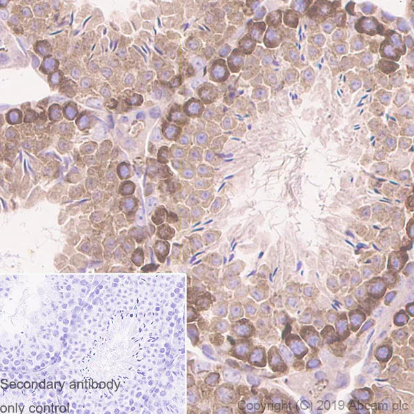 Immunohistochemistry (Formalin/PFA-fixed paraffin-embedded sections) - Anti-YTHDC2 antibody [EPR21820-49] - BSA and Azide free (AB259277)