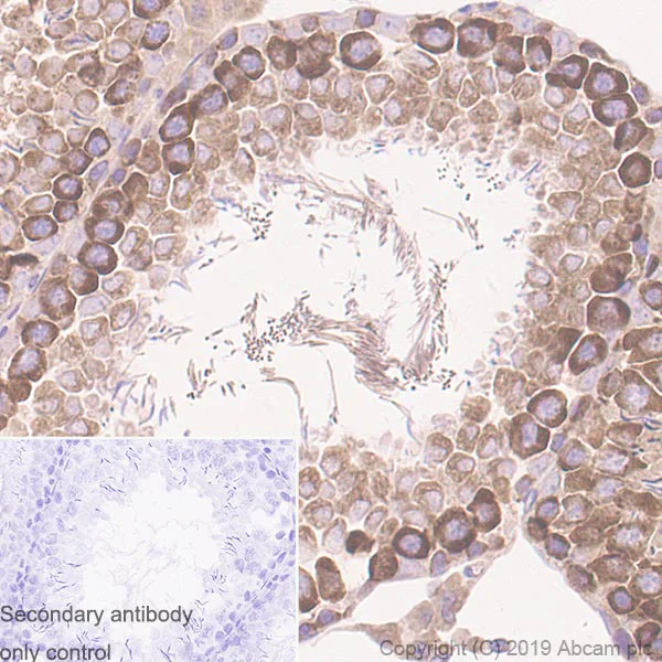 Immunohistochemistry (Formalin/PFA-fixed paraffin-embedded sections) - Anti-YTHDC2 antibody [EPR21820-49] - BSA and Azide free (AB259277)