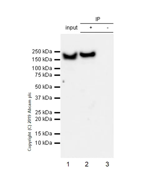 Immunoprecipitation - Anti-YTHDC2 antibody [EPR21820-49] - BSA and Azide free (AB259277)