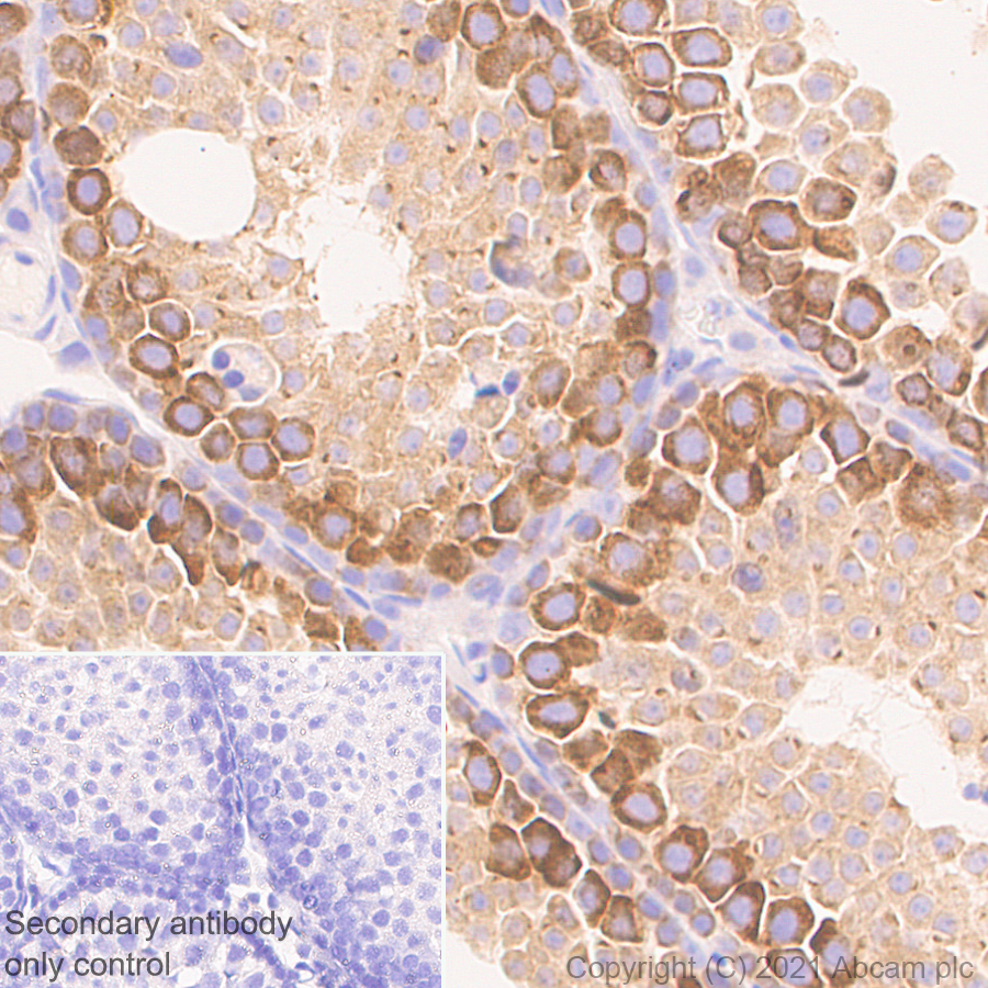 Immunohistochemistry (Formalin/PFA-fixed paraffin-embedded sections) - Anti-YTHDC2 antibody [EPR24278-9] - BSA and Azide free (ab283277), expandable thumbnail