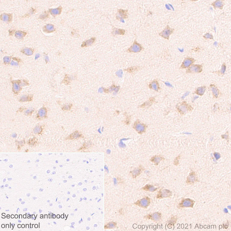 Immunohistochemistry (Formalin/PFA-fixed paraffin-embedded sections) - Anti-YTHDC2 antibody [EPR24278-9] - BSA and Azide free (AB283277)