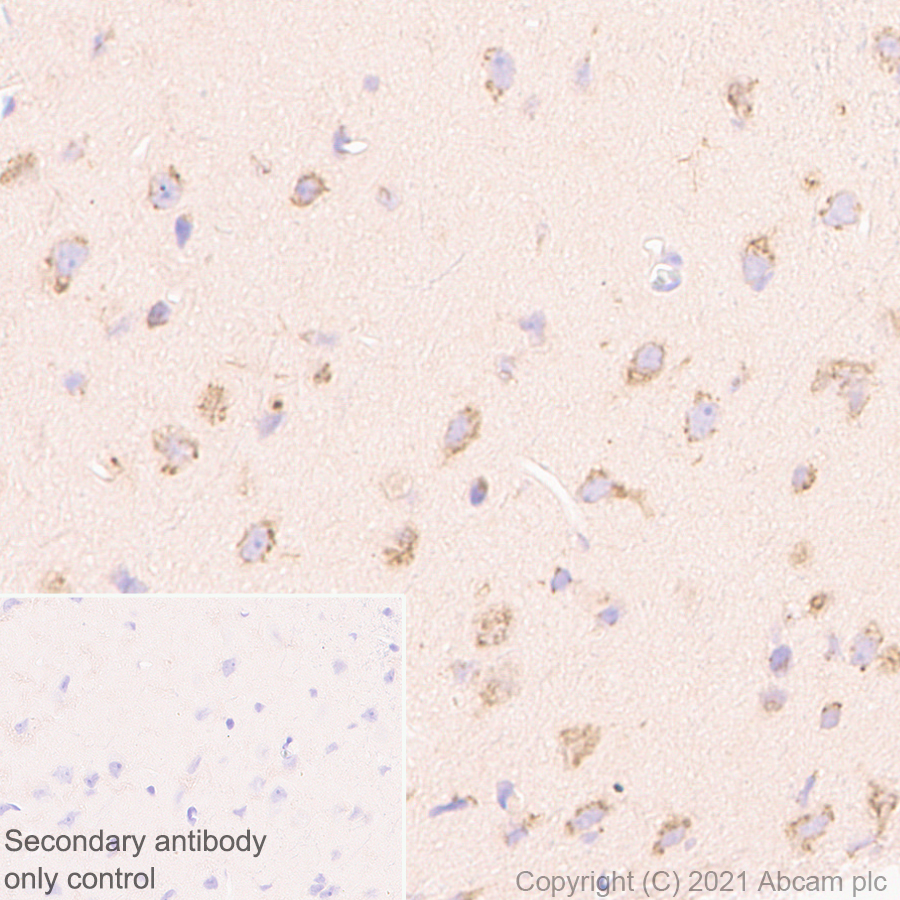 Immunohistochemistry (Formalin/PFA-fixed paraffin-embedded sections) - Anti-YTHDC2 antibody [EPR24278-9] - BSA and Azide free (ab283277), expandable thumbnail