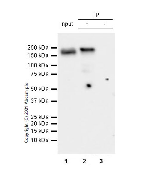 Immunoprecipitation - Anti-YTHDC2 antibody [EPR24278-9] - BSA and Azide free (AB283277), expandable thumbnail