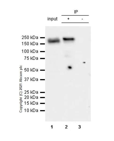 Immunoprecipitation - Anti-YTHDC2 antibody [EPR24278-9] - BSA and Azide free (AB283277)