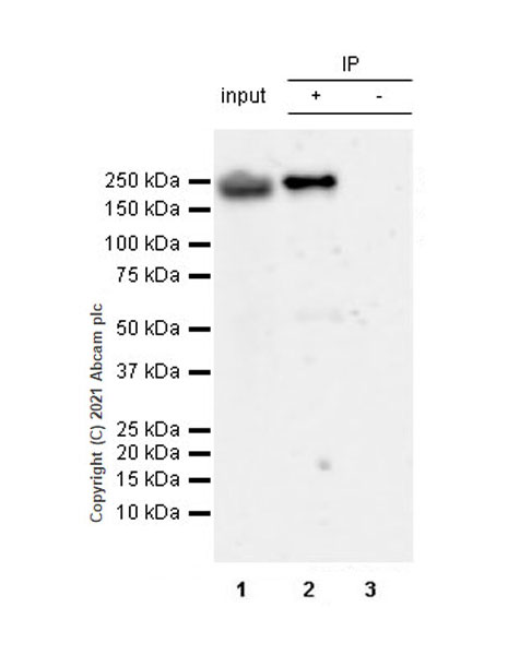 Immunoprecipitation - Anti-YTHDC2 antibody [EPR24278-9] - BSA and Azide free (AB283277), expandable thumbnail